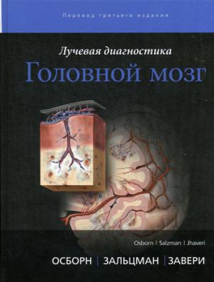 Лучевая диагностика. Головной мозг. В 3 т