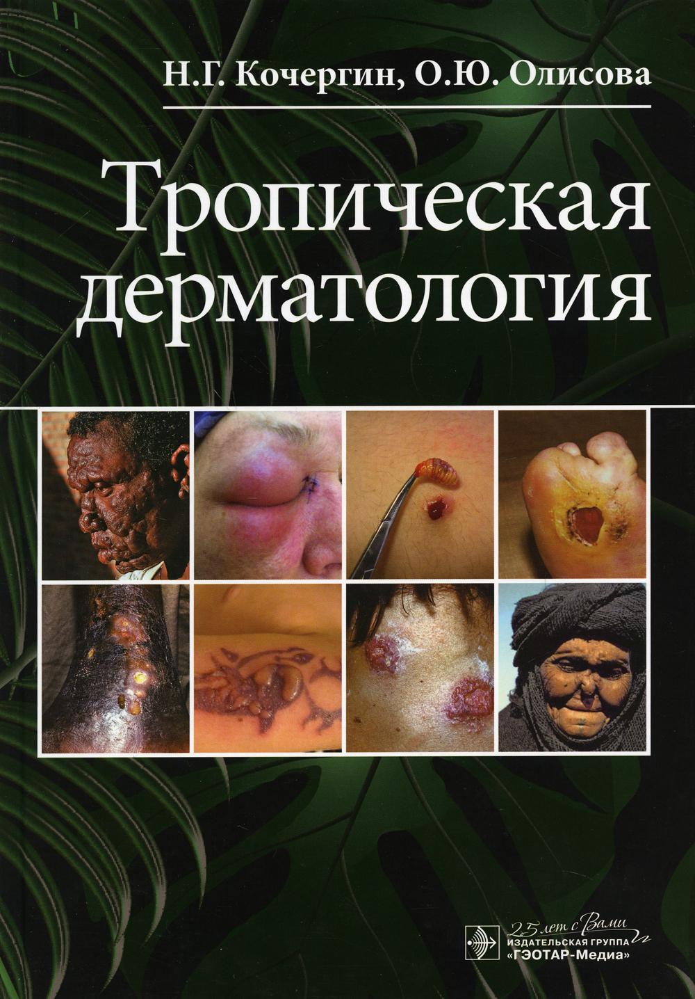Тропическая дерматология / Н. Г. Кочергин, О. Ю. Олисова. — Москва : ГЭОТАР-Медиа, 2020. — 104 с. : ил. — DOI: 10.33029/9704-5786-3-TD-2020-1-104.