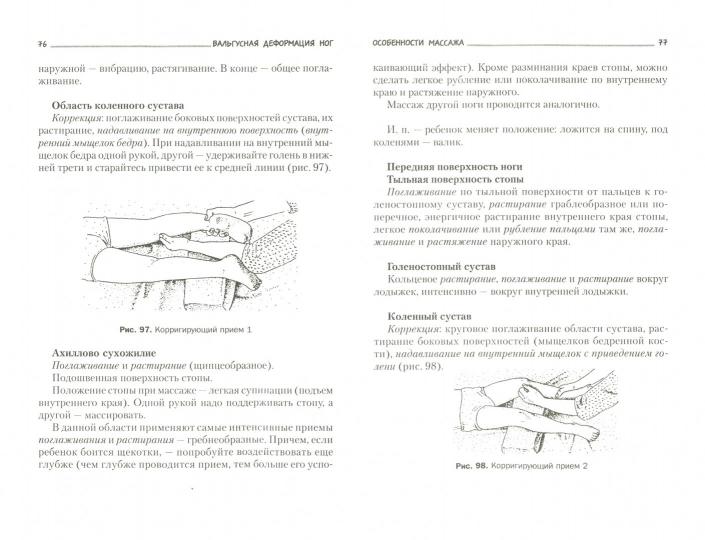 Плоскостопие. Профилактика и лечение