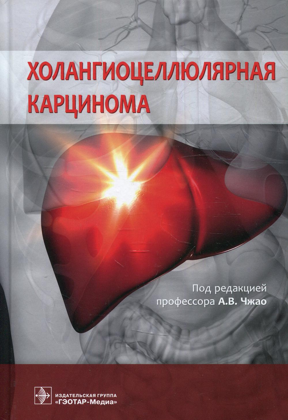 Холангиоцеллюлярная карцинома / под ред. А. В. Чжао. — Москва : ГЭОТАР-Медиа, 2021. — 368 с. : ил.