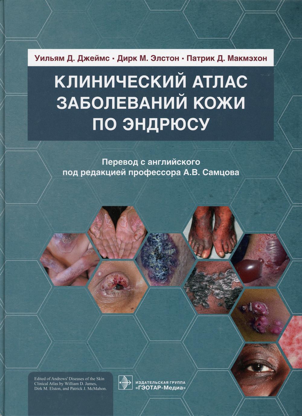 Клинический атлас заболеваний кожи по Эндрюсу / Уильям Д. Джеймс, Дирк М. Элстон, Патрик Д. Макмэхон ; пер. с англ. под ред. А. В. Самцова. — Москва : ГЭОТАР-Медиа, 2021. — 552 с. : ил.