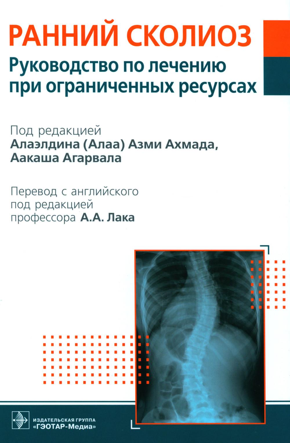 Ранний сколиоз. Руководство по лечению при ограниченных ресурсах / под ред. Алаэлдина (Алаа) Азми Ахмада, Аакаша Агарвала ; пер. с англ. под ред. А. А. Лака. ― Москва : ГЭОТАР-Медиа, 2023. ― 424 с. : ил.