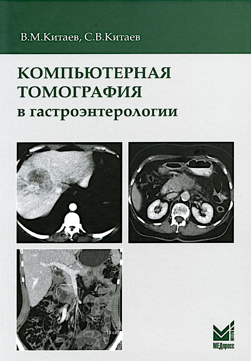 Компьютерная томография в гастроэнтерологии: руководство для врачей. 3-е изд., испр.и доп