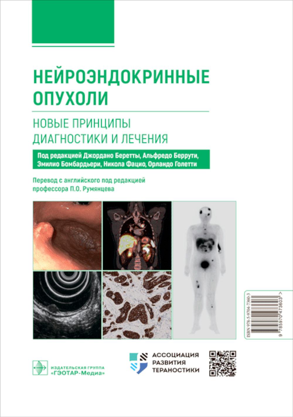 Нейроэндокринные опухоли. Новые принципы диагностики и лечения : руководство для врачей / под ред. Дж. Беретты, А. Беррути, Э. Бомбардьери ; пер. с англ. под ред. П. О. Румян це ва. — Москва : ГЭОТАР-Медиа, 2023. — 352 с. : ил.