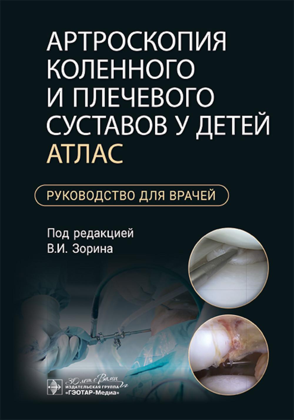 Артроскопия коленного и плечевого суставов у детей. Атлас : руководство для врачей / под ред. В. И. Зорина. — Москва : ГЭОТАР-Медиа, 2024. — 136 с. : ил.