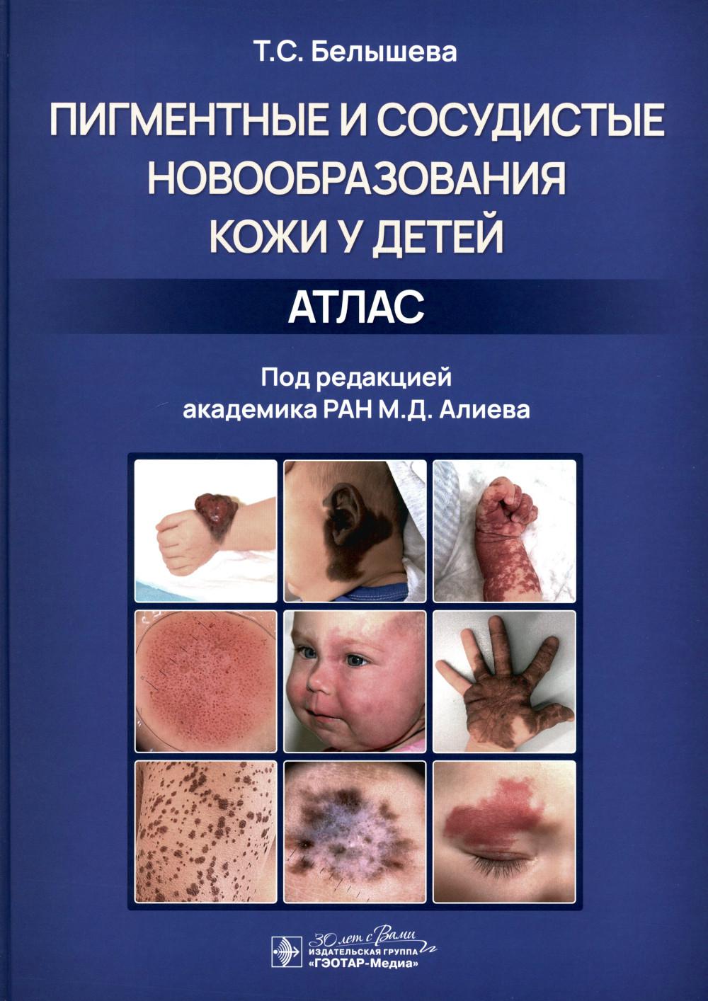 Пигментные и сосудистые новообразования кожи у детей. Атлас / Т. С. Белышева ; под ред. М. Д. Алиева. — Москва : ГЭОТАР-Медиа, 2023. — 136 с. : ил.