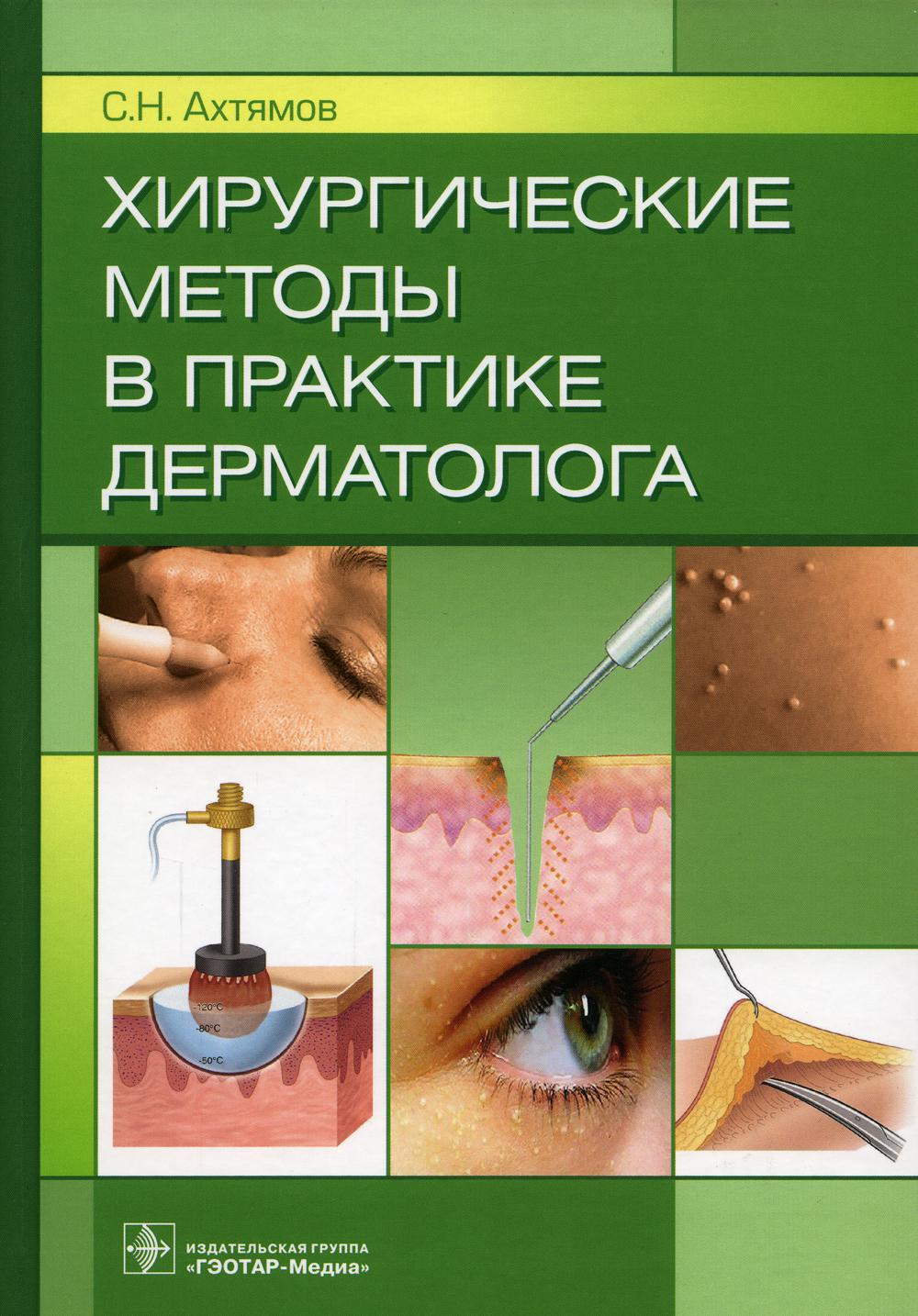 Хирургические методы в практике дерматолога / С. Н. Ахтямов. — Москва : ГЭОТАР-Медиа, 2022. — 352 с. : ил.