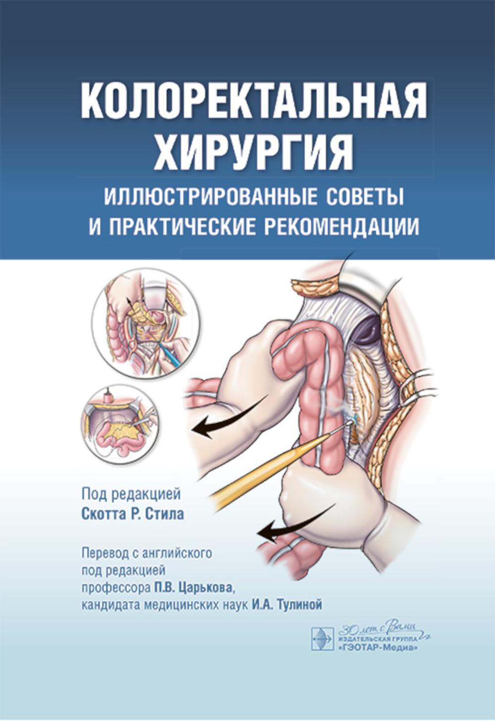 Колоректальная хирургия. Иллюстрированные советы и практические рекомендации / под ред. Скотта Р. Стила ; пер. с англ. под ред. П. В. Царькова, И. А. Тулиной. — Москва : ГЭОТАР-Медиа, 2025. — 880 с.