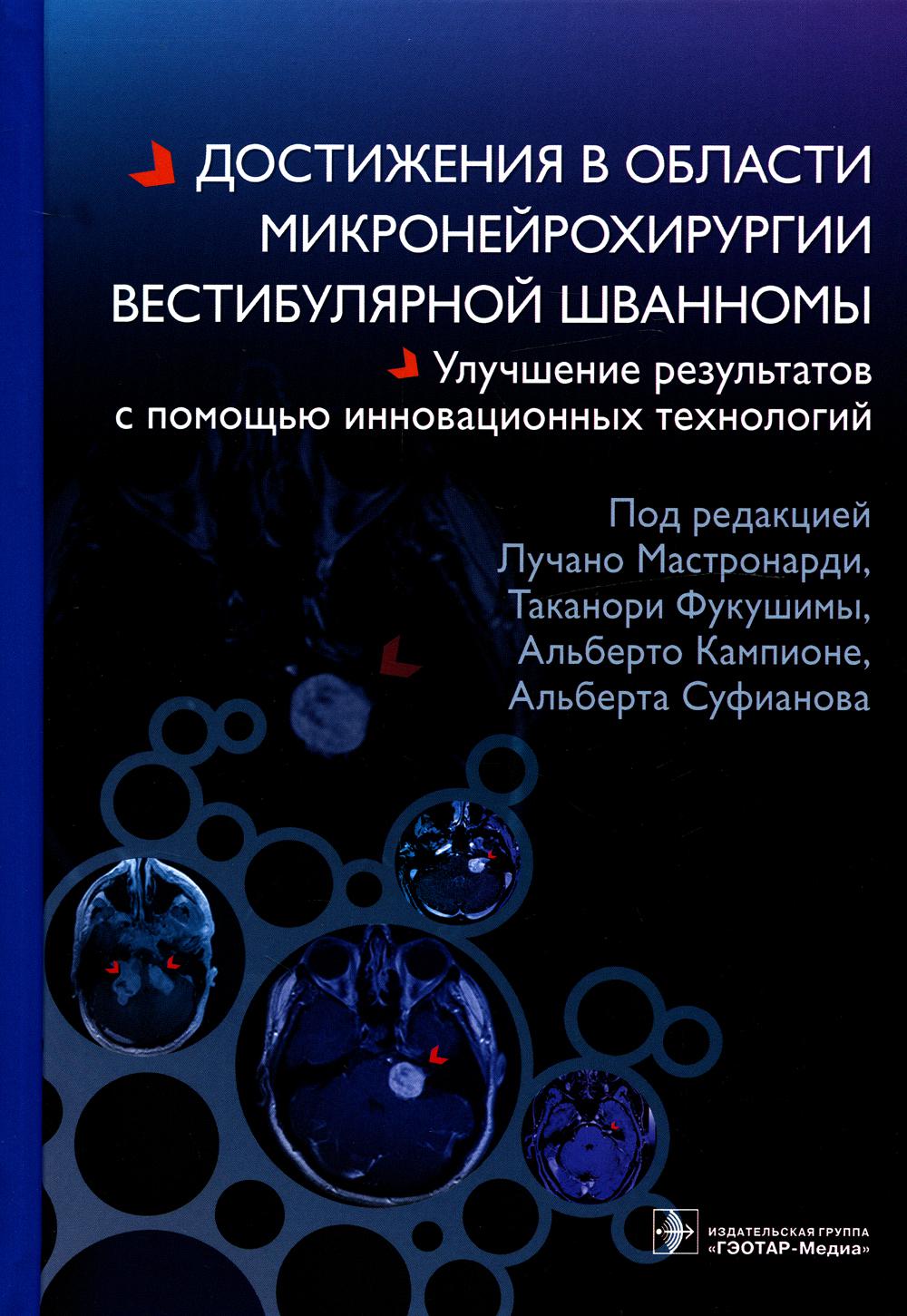 Достижения в области микронейрохирургии вестибулярной шванномы. Улучшение результатов с помощью инновационных технологий / под ред. Л. Мастронарди, Т. Фукушимы, А. Кампионе, А. Суфианова ; пер. с англ. — Москва : ГЭОТАР-Медиа, 2022. — 208 с. : ил.