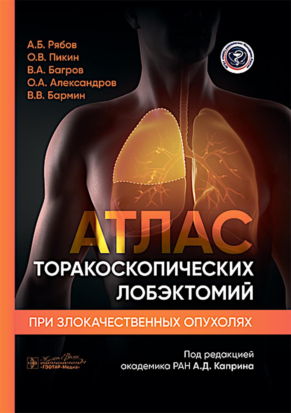 L'Atlas torakoscopicheskih лобэктомий при злокачественных опухолях