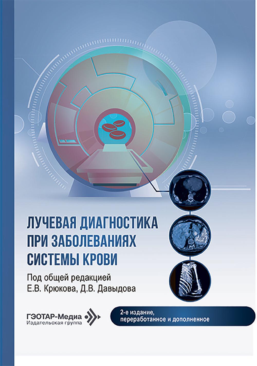 Лучевая диагностика при заболеваниях системы крови / под общ. ред. Е. В. Крюкова, Д. В. Давыдова. — 2-е изд., перераб. и доп. — Москва : ГЭОТАР-Медиа, 2026. — 304 с.