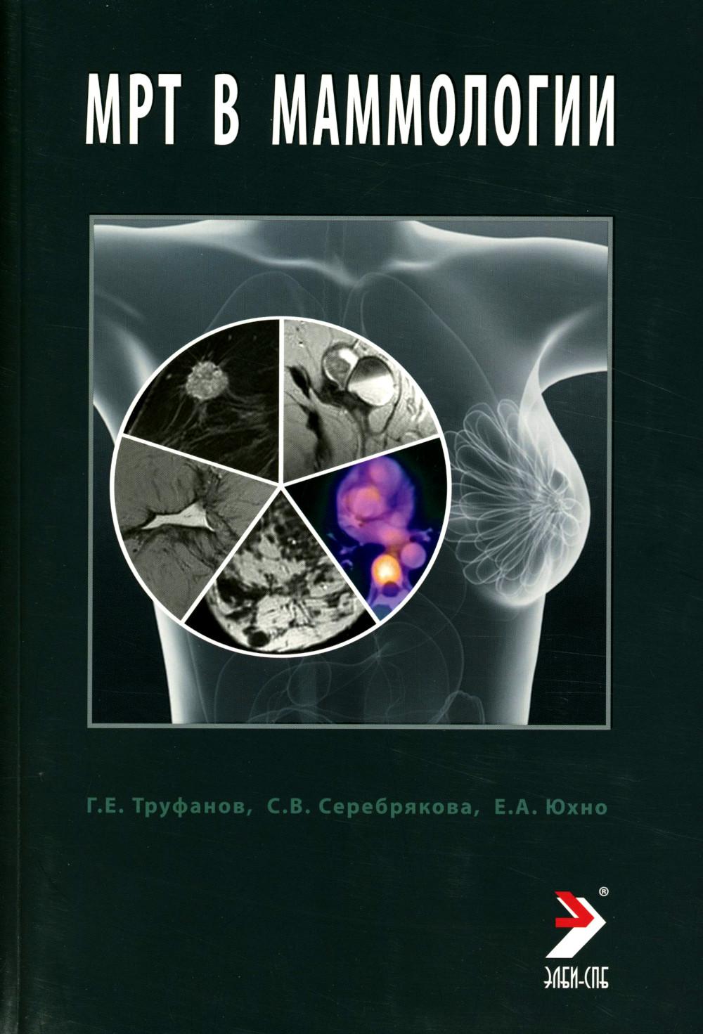 МРТ в маммологии: руководство для врачей