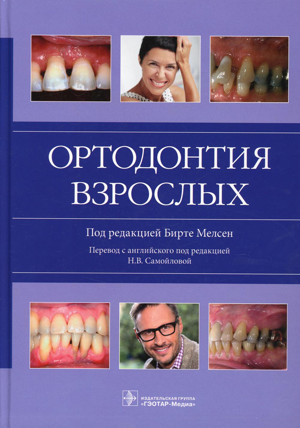 Ортодонтия взрослых / под ред. Бирте Мелсен ; пер. с англ. под ред. Н. В. Самойловой. — М. : ГЭОТАР-Медиа, 2019. — 416 с. : ил.