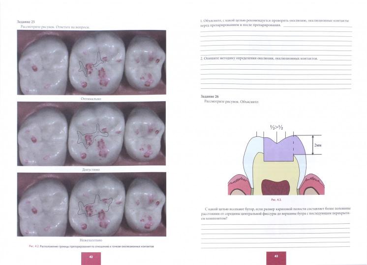 Препарирование кариозных полостей. Пропедевтика стоматологических заболеваний. Рабочая тетрадь для самостоятельной подготовки студентов и контроля усвоения компетенции модуля. Учебно-методическое пособие