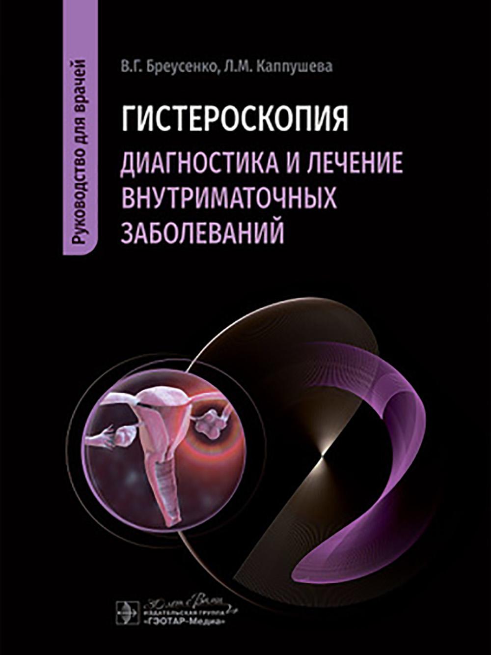 Гистероскопия. Диагностика и лечение внутриматочных заболеваний : руководство для врачей / В. Г. Бреусенко, Л. М. Каппушева. — Москва : ГЭОТАР-Медиа, 2025. — 440 c. : ил.