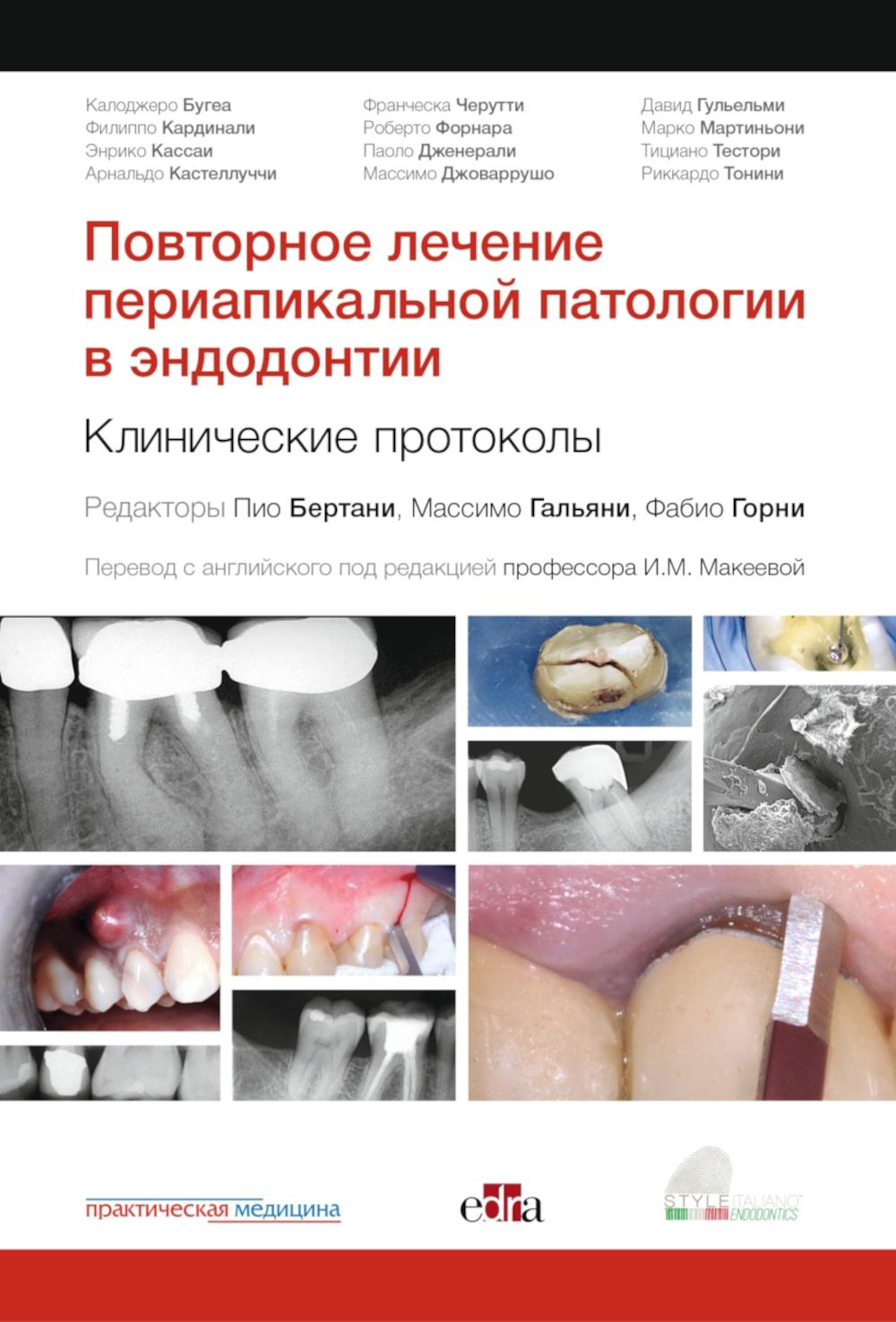 Повторное лечение периапикальной патологии в эндодонтии. Клинические протоколы