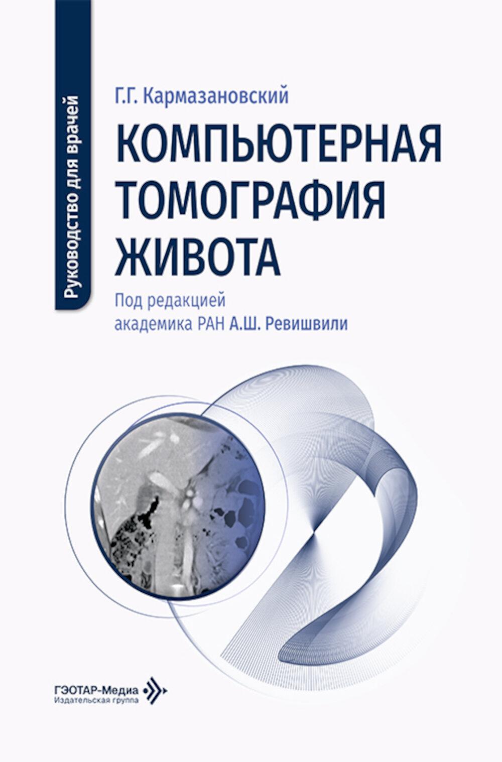 Компьютерная томография живота: руководство для врачей