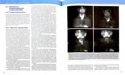 Общая оториноларингология - Хирургия головы и шеи. В 2 т. Энтони П. Склафани и др.
