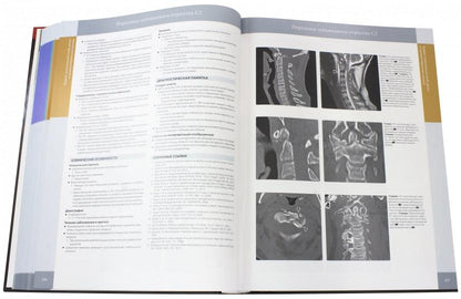Лучевая диагностика. Позвоночник