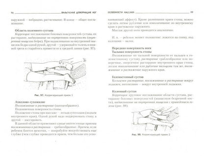 Плоскостопие. Профилактика и лечение