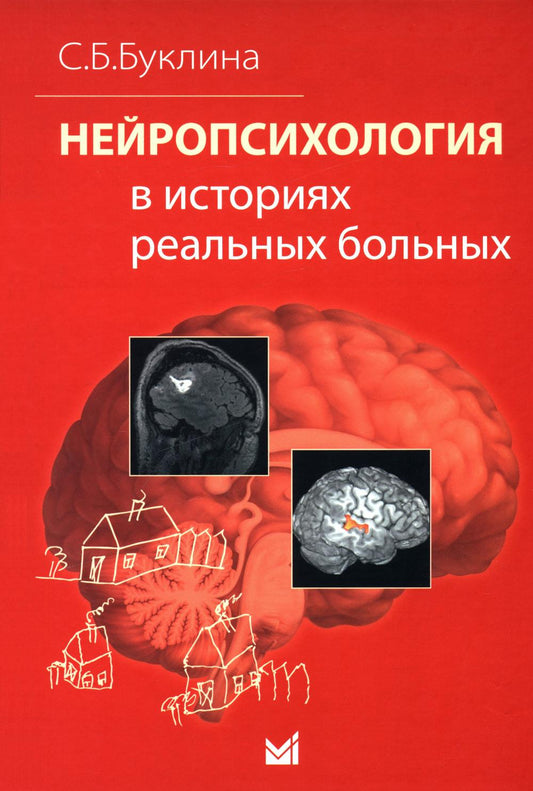 Нейропсихология в историях реальных больных