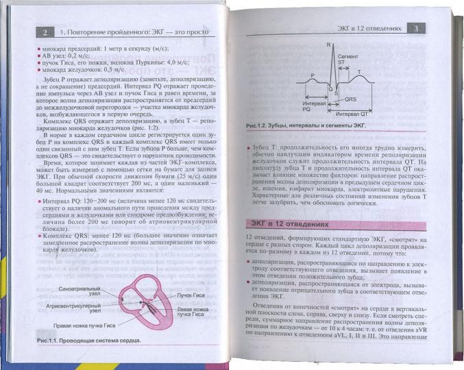 ЭКГ в практике врача
