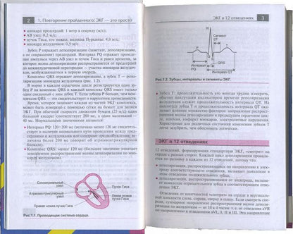 ЭКГ в практике врача