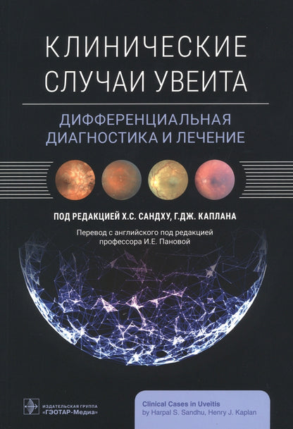 Клинические случаи увеита. Дифференциальная диагностика и лечение / под ред. Х. С. Сандху, Г. Дж. Каплана ; пер. с англ. под ред. И. Е. Пановой. ― Москва : ГЭОТАР-Медиа, 2023. ― 496 с.