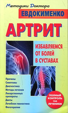 Артрит.Избавляемся от болей в суставах