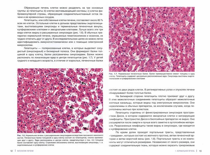 Патология печени для клиницистов