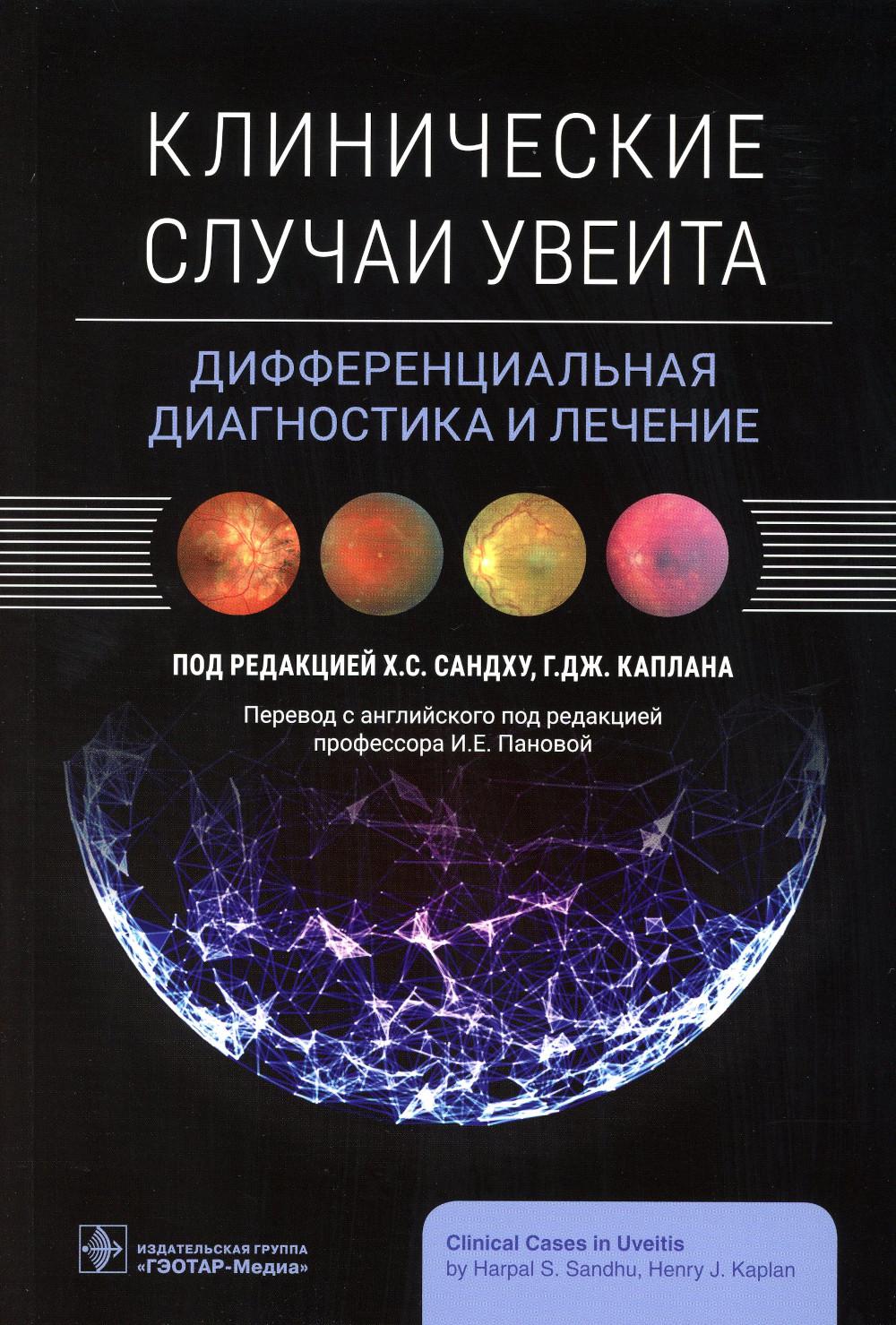 Клинические случаи увеита. Дифференциальная диагностика и лечение / под ред. Х. С. Сандху, Г. Дж. Каплана ; пер. с англ. под ред. И. Е. Пановой. ― Москва : ГЭОТАР-Медиа, 2023. ― 496 с.