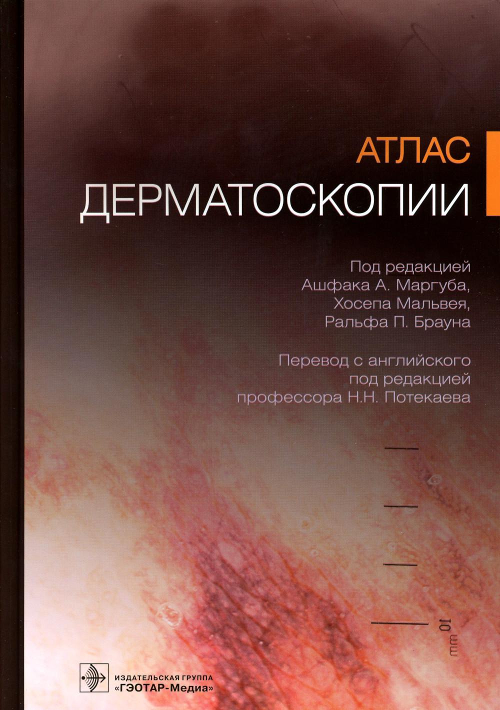 Атлас дерматоскопии / под ред. Ашфака А. Маргуба, Хосепа Мальвея, Ральфа П. Брауна ; пер. с англ. под ред. Н. Н. Потекаева. — Москва : ГЭОТАР-Медиа, 2023. — 472 с. : ил.
