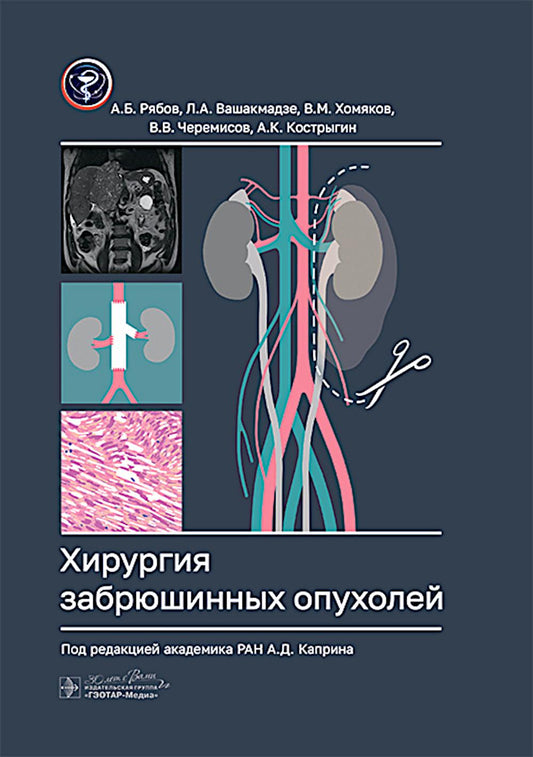 Хирургия забрюшинных опухолей / А. Б. Рябов, Л. А. Вашакмадзе, В. М. Хомяков [и др.] ; под ред. А. Д. Каприна. — Москва : ГЭОТАР-Медиа, 2025. — 216 с. : ил.