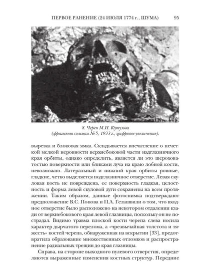Ранения и смерть фельдмаршала Кутузова