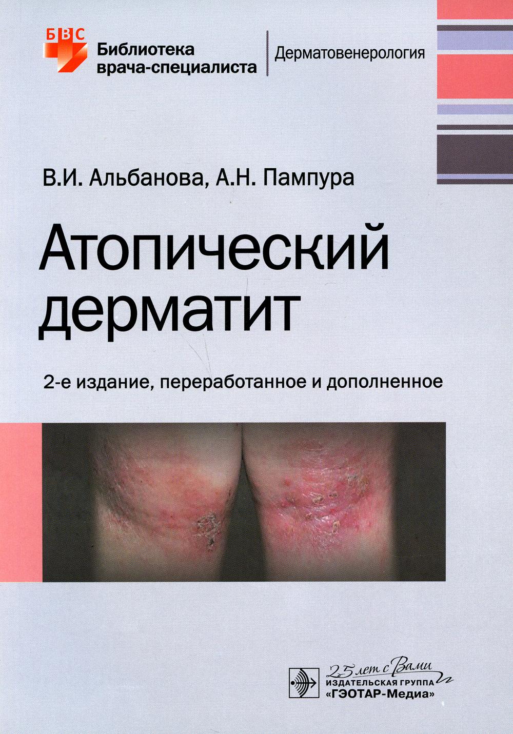 Атопический дерматит / В. И. Альбанова, А. Н. Пампура. — 2-е изд., перераб. и доп. — Москва : ГЭОТАР-Медиа, 2020. — 144 с. : ил. — (Серия «Библиотека врача-специалиста»). — DOI: 10.33029/9704-5640-8-АТП-2020-1-144.