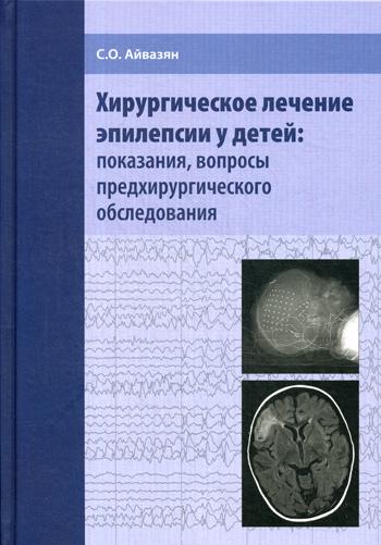 Хирургическое лечение эпилепсии у детей: обстоятельства, вопросы предоперационного обследования. Айвазян С.О.