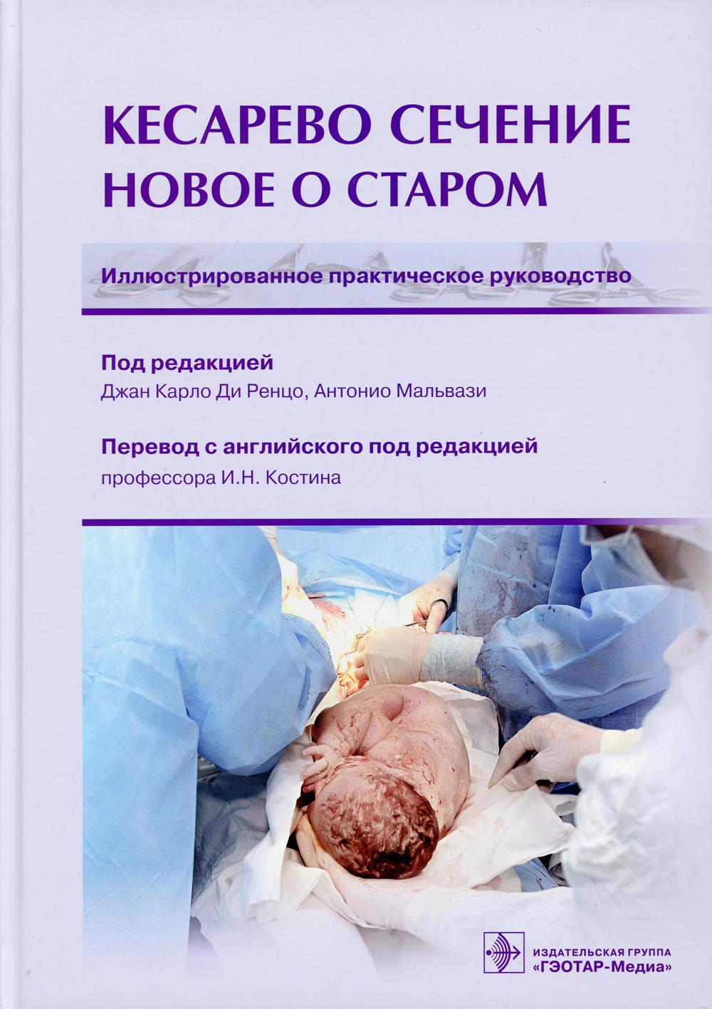 Кесарево сечение. Новое о старом. Иллюстрированное практическое руководство / под ред. Д. К. Ди Ренцо, А. Мальвази ; пер. с англ. под ред. И. Н. Костина. — Москва : ГЭОТАР-Медиа, 2021. — 368 с. : ил.