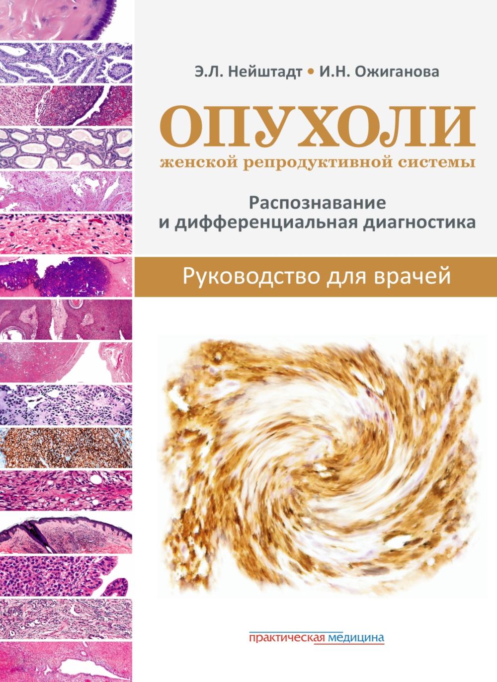 Опухоли женской репродуктивной системы. Распознавание и дифференциальная диагностика. Руководство для врачей***
