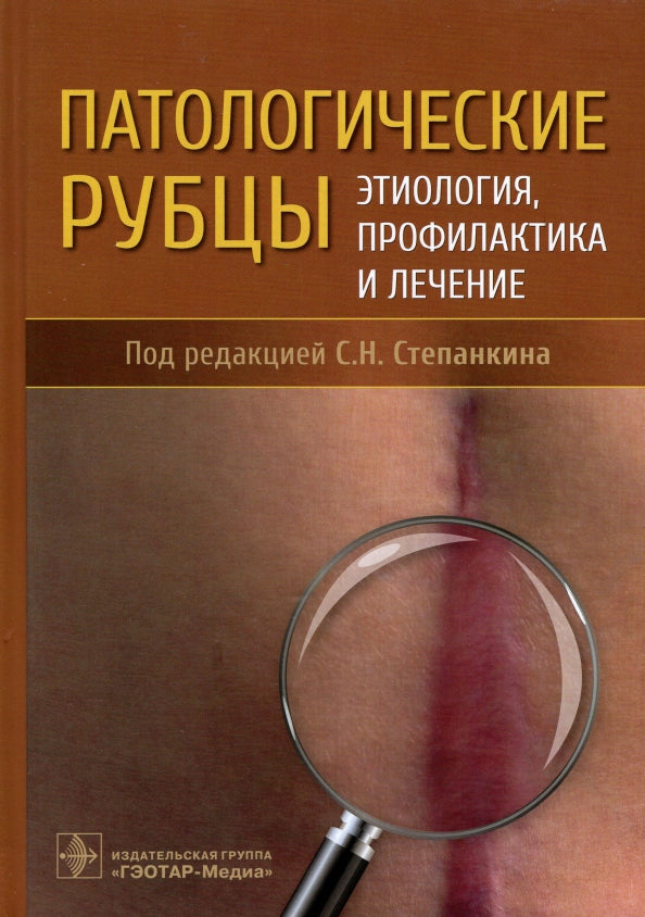 Патологические рубцы. Этиология, профилактика и лечение / Под ред. С. Н. Степанкина. — Москва : ГЭОТАР-Медиа, 2022. — 408 с. : ил.