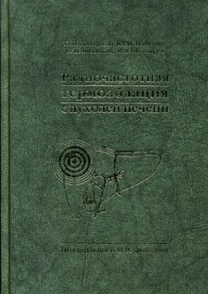 Радиочастотная термоаблация опухолей печени