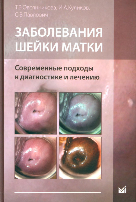 Заболевания шейки матки. Современные подходы к диагностике и индивидуальному подходу: Учебное пособие для врачей.
