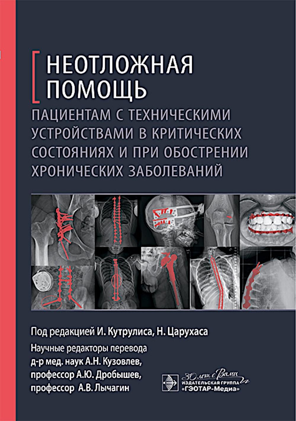 Неотложная помощь пациентам с техническими устройствами в критических состояниях и при обострении хронических заболеваний / под ред. И. Кутрулиса, Н. Царухаса; пер. с англ. под ред. А. Н. Кузовлева, А. Ю. Дробышева, А. В. Лычагина. — Москва : ГЭОТАР-Медиа