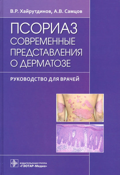 Псориаз. Современные представления о дерматозе : руководство для врачей / В. Р. Хайрутдинов, А. В. Самцов. — Москва : ГЭОТАР-Медиа, 2021. — 260 с.