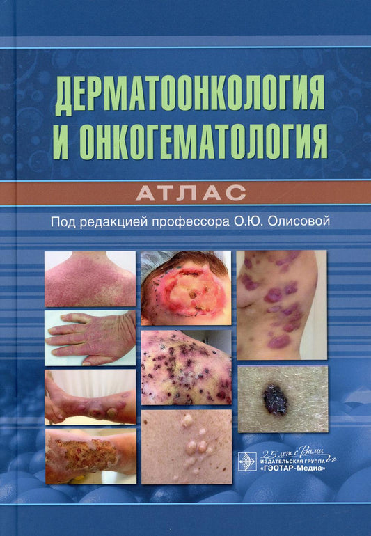 Дерматоонкология и онкогематология. Атлас / под ред. О. Ю. Олисовой. — Москва : ГЭОТАР-Медиа, 2020. — 144 с. : ил. — DOI: 10.33029/9704-5413-8-DOA-2020-1-144.
