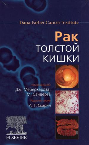 Рак толстой кишки