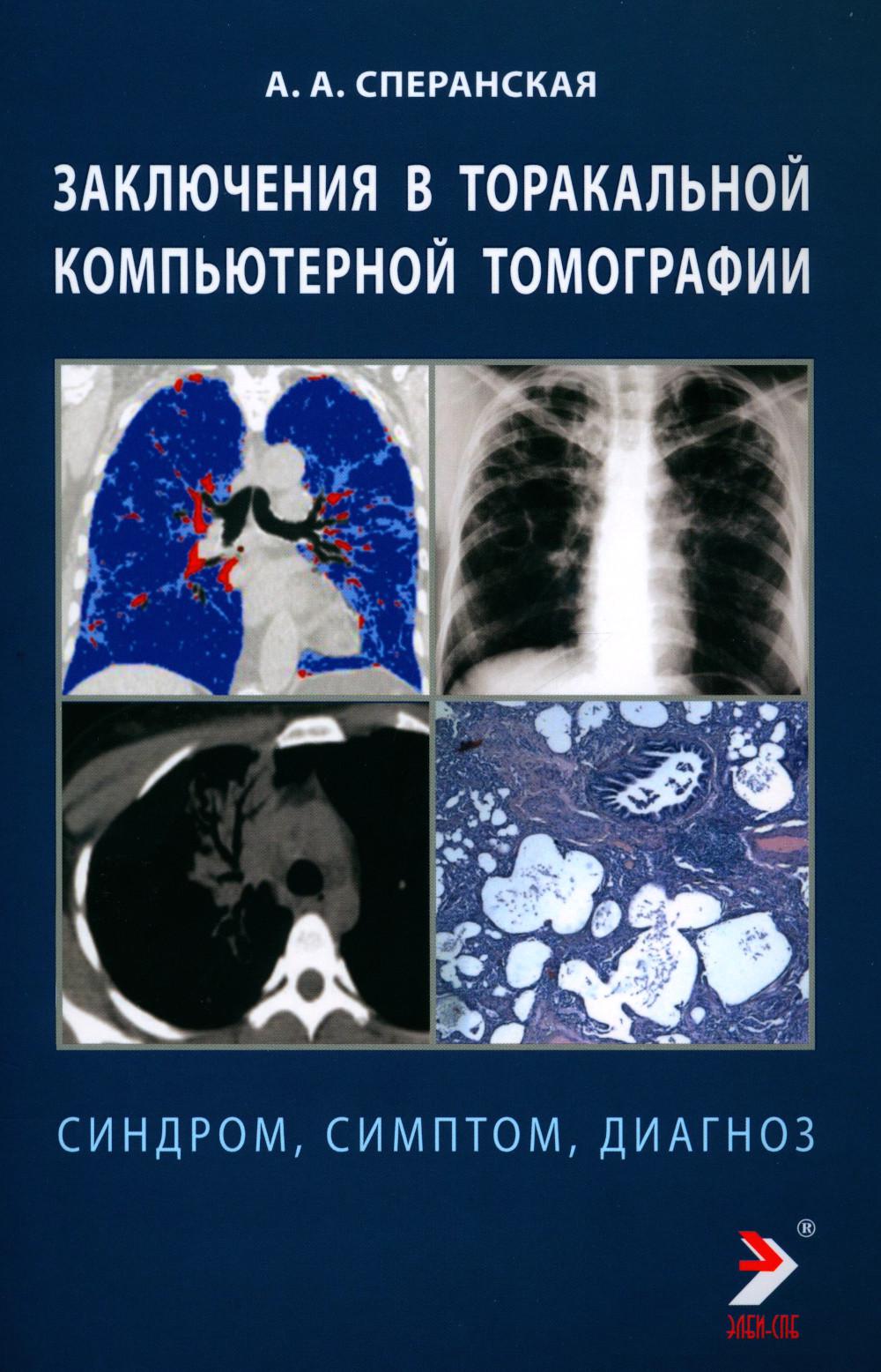 Заключение в торакальной компьютерной томографии. Симптом, синдром, диагноз. 2-е изд