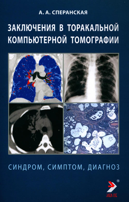 Заключение в торакальной компьютерной томографии. Симптом, синдром, диагноз. 2-е изд