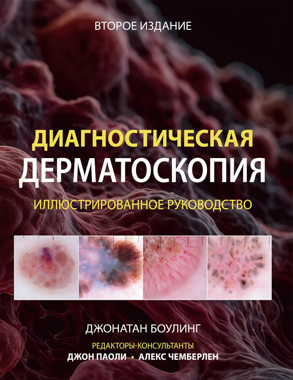 Диагностическая дерматоскопия: иллюстрированное руководство. 2-е изд