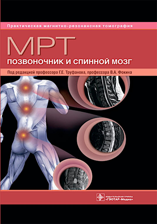 МРТ. Позвоночник и спинной мозг : руководство для врачей / под ред. Г. Е. Труфанова, В. А. Фокина. — Москва : ГЭОТАР-Медиа, 2025. — 544 с. : ил. — (Серия «Практическая магнитно-резонансная томография»).