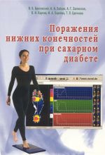 Поражения нижних конечностей при сахарном диабете